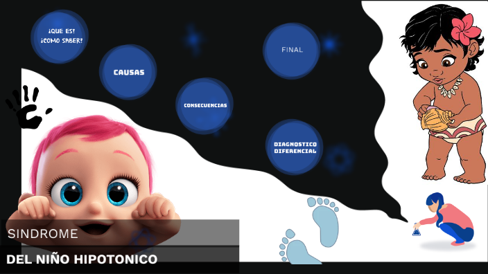 Sindrome del Niño Hipotonico by Juan David Gomez Armero on Prezi