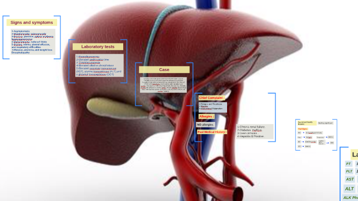 chronic-hepatic-failure-by-sara-ruaili-on-prezi