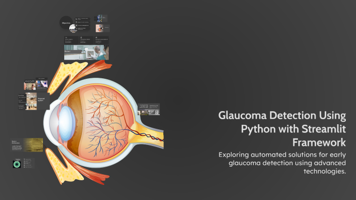 Glaucoma Detection Using Python with Streamlit Framework by ABDULLA D ...
