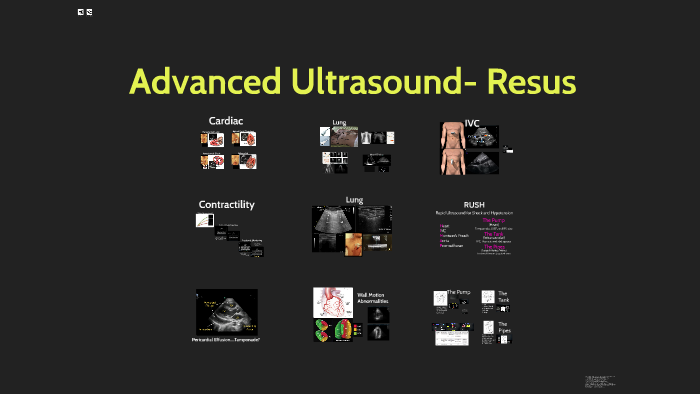 resus ultrasound