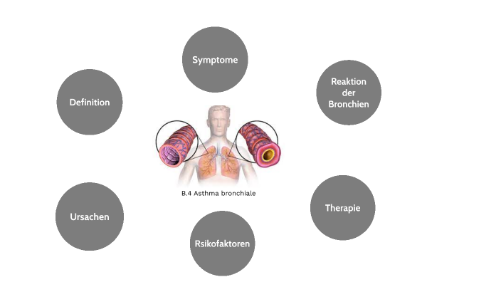 Asthma Bronchiale By Steffi Mala On Prezi