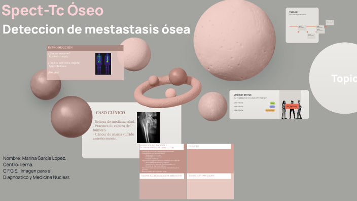 Spect-Tc Óseo by Marina García López on Prezi