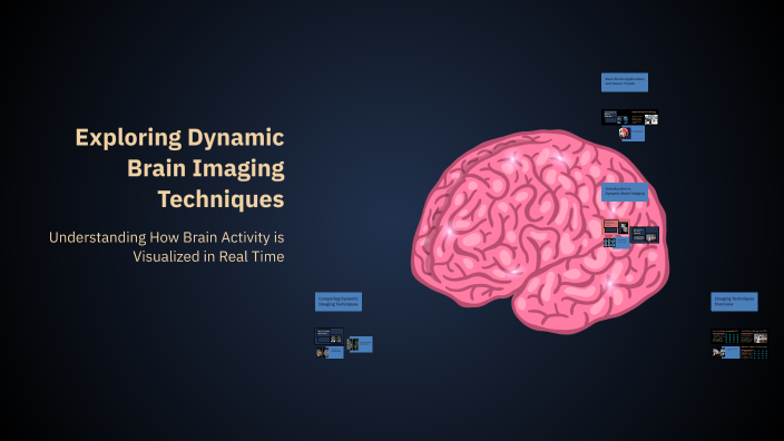 Dynamic Brain Scan Exploring Dynamic Brain Imaging Techniques by Nida Hashmi on Prezi