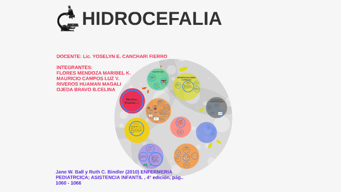 Hidrocefalia By Joel B Bravo Hilario On Prezi 9557