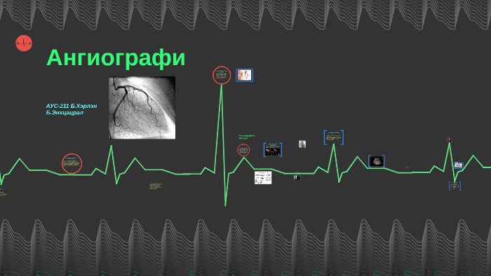 Ангиографи by Үсаги Цацаа on Prezi