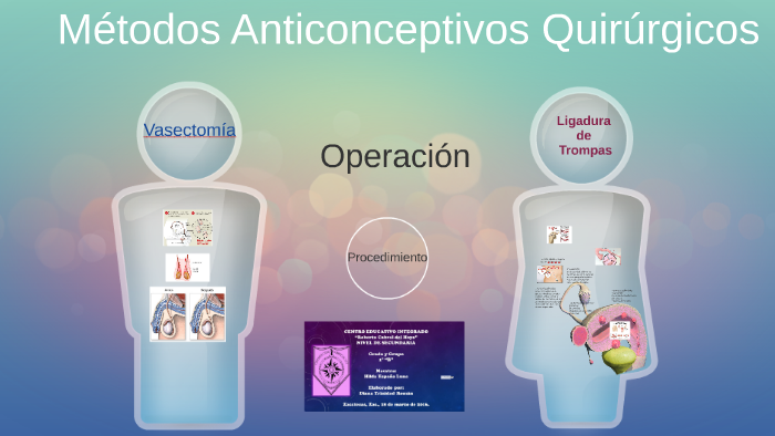 Métodos Anticonceptivos Quirúrgicos By Sus Trir 1550