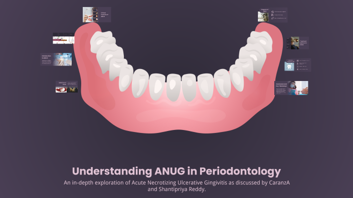 Understanding ANUG in Periodontology by Anushkaa Bhoskar on Prezi