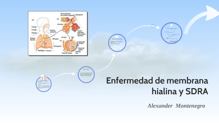 Enfermedad de membrana hialina y SDRA by alexander montenegro on Prezi