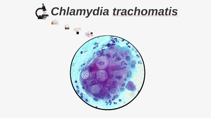 Chlamydia Trachomatis.