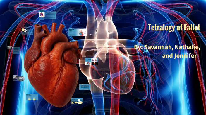 Tips On Understanding Fallouts Understanding Tetralogy of Fallot by savannah farley on Prezi