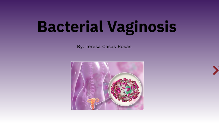 Bacterial Vaginosis by Teresa Casas on Prezi