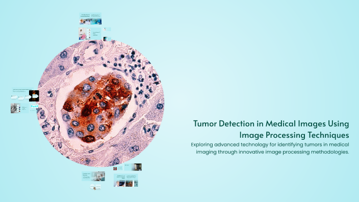 Tumor Detection in Medical Images Using Image Processing Techniques by ...