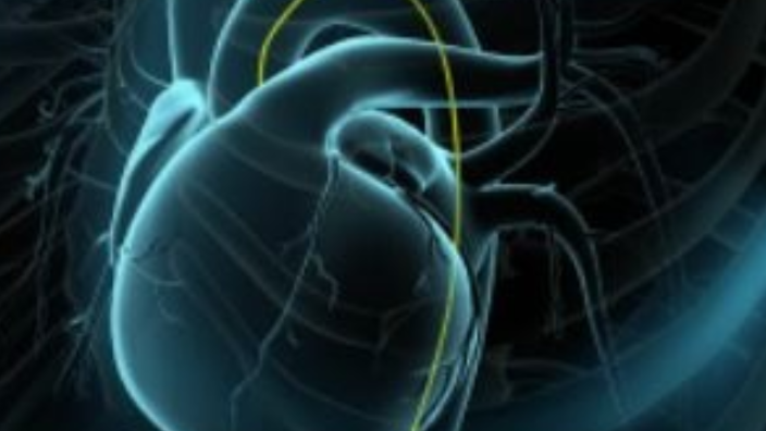 Coronariografía Y Angioplastia Coronaria Transpercutánea Actp By Yeni Coronariografía Y Angioplastia Coronaria Transpercutánea Actp By Yeni