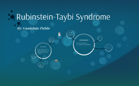 Rubinstein-Taybi Syndrome - an overview