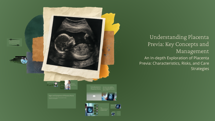 Understanding Placenta Previa: Key Concepts and Management by Lauren ...