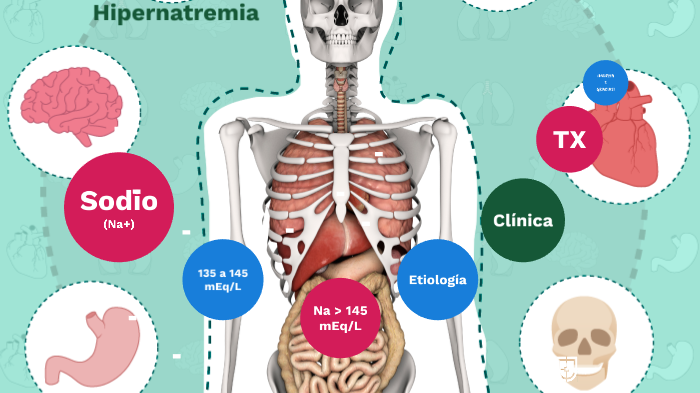 Hipernatremia by Marybel Garcia Rodriguez on Prezi