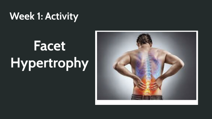 Facet Hypertrophy by Tracy Riser on Prezi