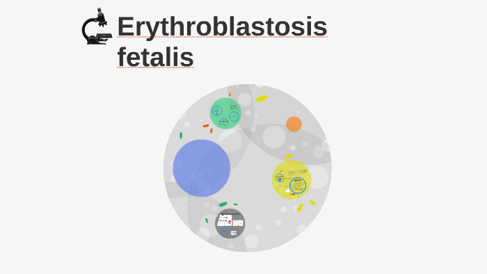 Erythroblastosis Fetalis By Erika Milisauskaitė