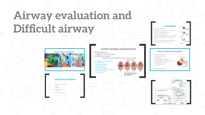 Difficult Airway By Raluca Gosman On Prezi