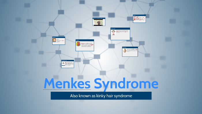 Menkes Syndrome By Kendel Garcia On Prezi