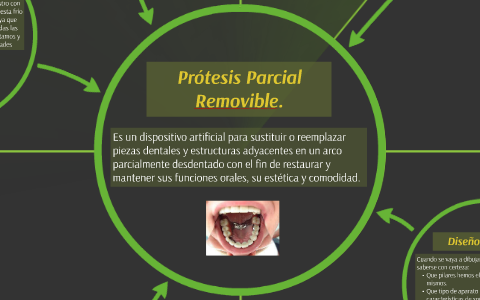 protesis parcial removible. by itzel muñiz angeles on Prezi Next