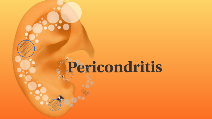 Pericondritis by Layla Rodríguez Carrasco on Prezi