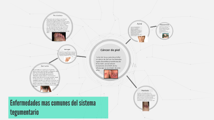 Enfermedades mas comunes del sistema tegumentario by marcos araujo on Prezi