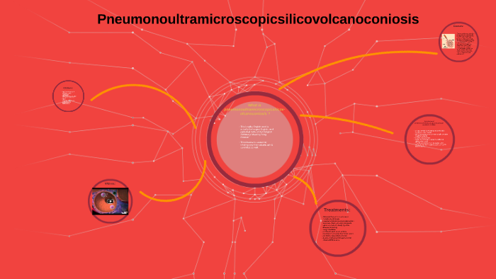 Pneumonoultramicroscopicsilicovolcanoconiosis By James Hernandez