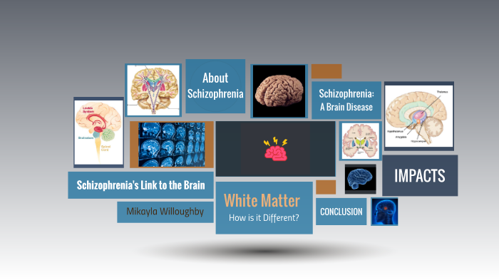 Areas Of The Brain Affected By Schizophrenia By Mikayla Willoughby On Prezi