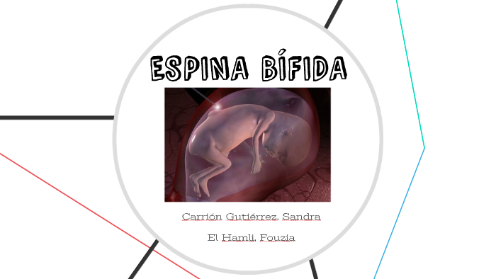Espina BÍfida By Sandra Carrión 5441