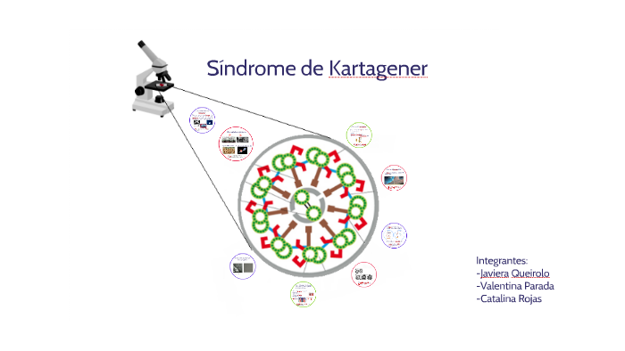Síndrome de Kartagener by Valentina Parada on Prezi