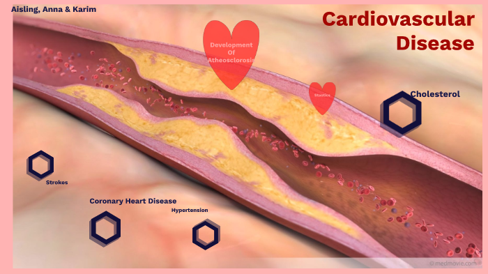 Heart by Karim Nori on Prezi