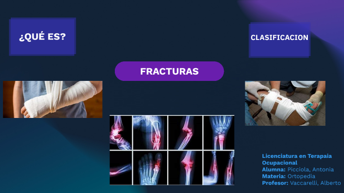 Fracturas by Antonia Picciola on Prezi