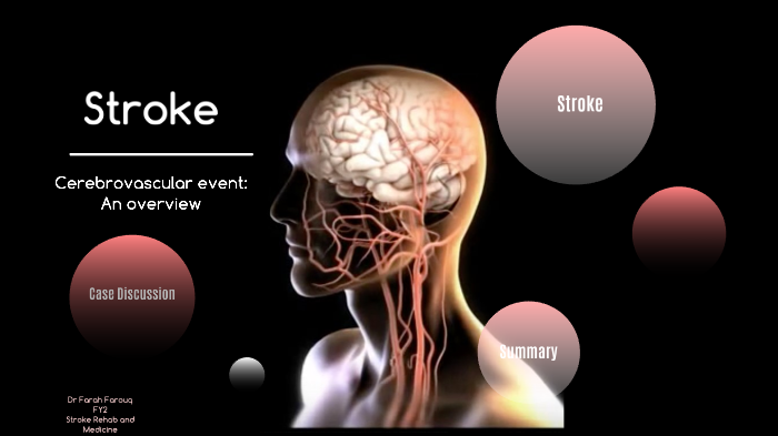 presentation of a stroke