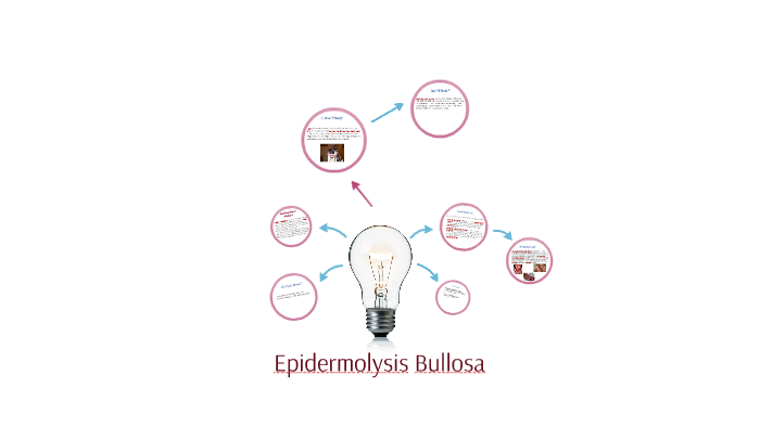 Harlequin-type Ichthyosis by Janine Dela Sierra on Prezi