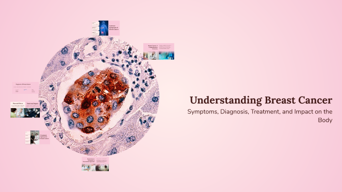 Understanding Breast Cancer by kylie wilson on Prezi
