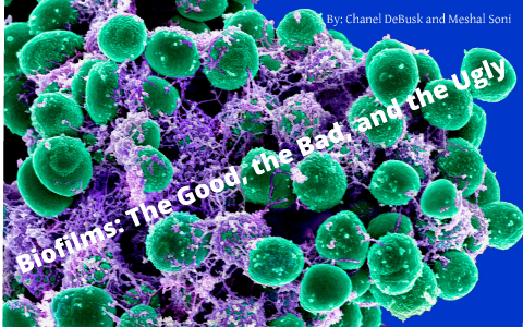 Biofilms: The Good, the Bad, and the Ugly by Chanel DeBusk