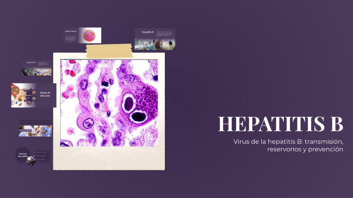 HEPATITIS B by Daniela Gonzales on Prezi