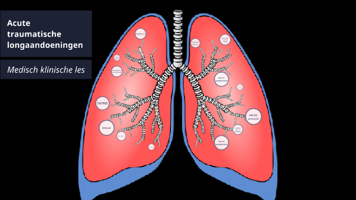 Thoraxdrainage bij acute traumatische longaandoeningen by Rhana Olde ...