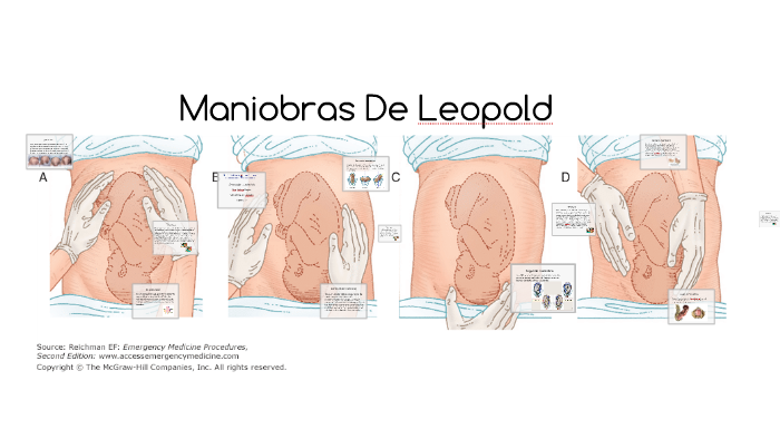 Maniobras de leopold by alejandra penago