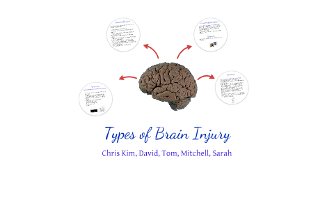 Types of Brain Injury by Chris Kim on Prezi