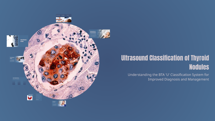 Ultrasound Classification of Thyroid Nodules by Khalid Seedahmed on Prezi