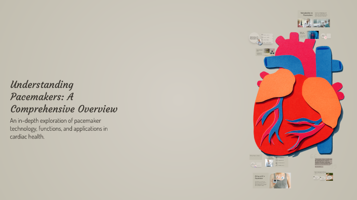 Understanding Pacemakers Understanding Pacemakers: A Comprehensive Overview by Anagha A S on Prezi