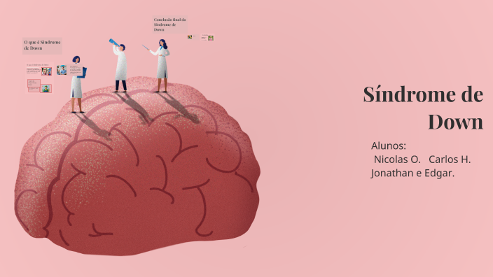 Síndrome de Down by Nik True. on Prezi