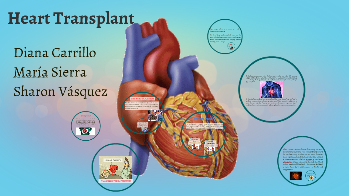 Heart Transplant By