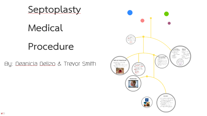 Septoplasty Medical Procedure By Deanicia Delizo