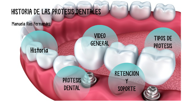 historia de la protesis dental by manuela ríos fernandez on Prezi