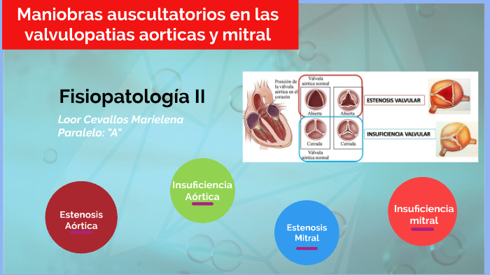 fisiopatología de la regurgitación aórtica