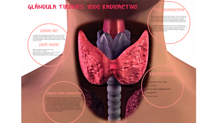YODO RADIOACTIVO by Alejandro Reverte on Prezi