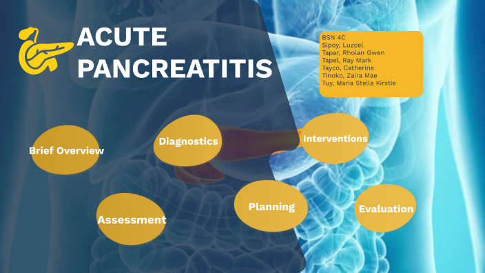 Acute Pancreatitis by RAY MARK REYNANCIA TAPEL